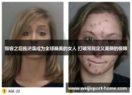 毁容之后我逆袭成为全球最美的女人 打破常规定义美丽的极限